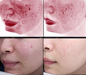 Sensitive skin soothing essential oil